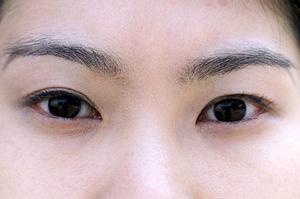 ダーマペン4の治療も可能な心斎橋の病院