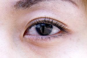 フェイスリフトで若返りましょう。